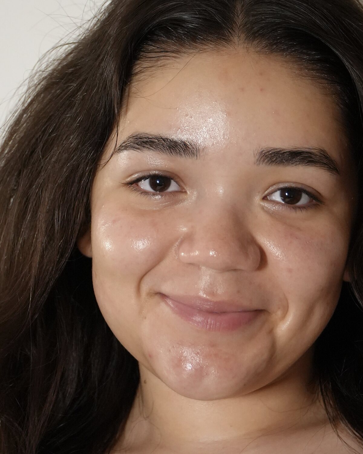 The same client's skin after her facial, shown on the right